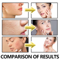 Anti-Wrinkle Filler Cream,Power Wrinkle Fix Cream,Wrinkle Fil-ler Serum,Wrin-kle Filler Face Crea-m,Skin Tightening Cre-am for Face,Fac-e Moisturizer for Women,Fa-ce Serum for Women,Anti Ageing Cre-am