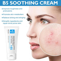 Tianyue 40ML Repair Face Cream,Vitamin B5 Face Moisturiser,Vitamin B5 Soothing Face Cream,Anti Redness Moisturiser Cream,Facial Cream for Men and Women,B5 Face Cream for Acne & Repair Damage Skin