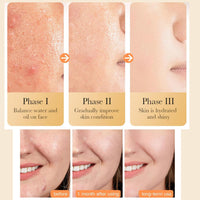 Fengyang®Turmeric Face Cream,Anti Aging Cream,Face Moisturiser,Brightening Face Cream for Skin,Natural Turmeric Cream Skin Care,Vitamin C Moisturiser for Face, Reduce Fine Lines, Even Skin Tone