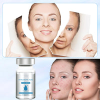 Bettinay 6PCS Lips Serum Beauty Kit, Micro Infusion Facial System for Deep Nourishment All Skin Types