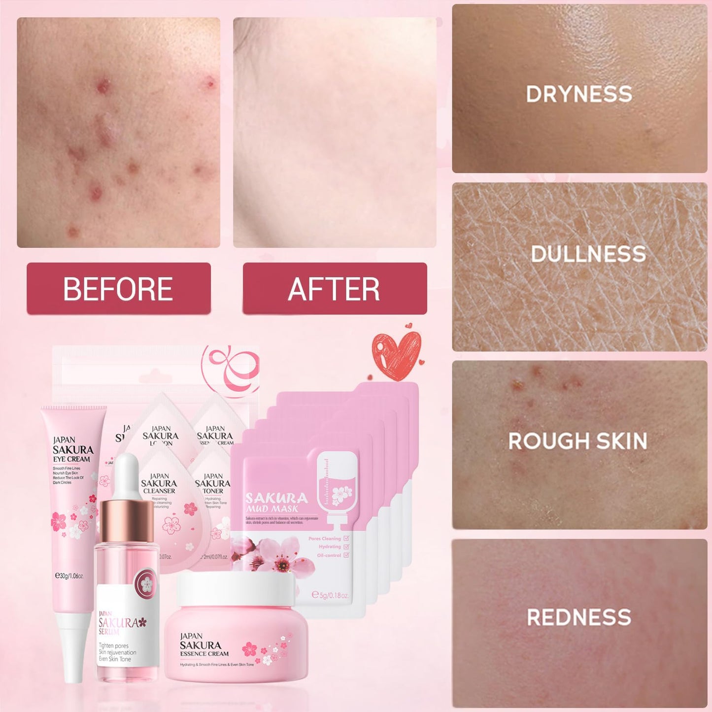 IZBEAUVO 28Pcs Sakura Skincare Gift Set, Refreshing Cherry Blossom Pamper Kit, Sakura Beauty Gift for Women, Japanese Cherry Blossom Skincare Set, Eye Cream, Face Serum & Cream, 5 Hydrating Set & 5 Mud Masks