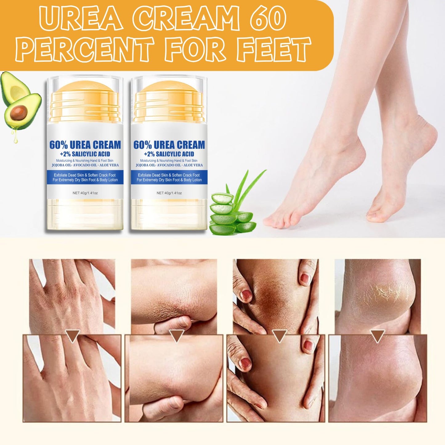 Trendyfave 60% Urea Cream For Cracked Heels - Urea Foot Cream - Foot Cream for Cracked Heels and Dry Skin - Cracked Heel Repair Cream - Skin Care Hands & Feet - Intense Moisturiser with Jojoba Oil & Aloe Vera