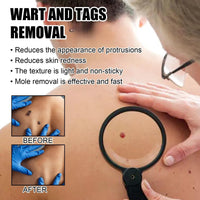 Jinjiar 2PCS Wart Remover Pen,Skin Wart Remover,Fast-Acting Wart Removal,Wart Freeze Removal,Foot & Hand Wart Strong Remover,Mole Remover,Natural Wart Re-Mover,Wart Re-Mover for Face,Flat Wa-rt Remover
