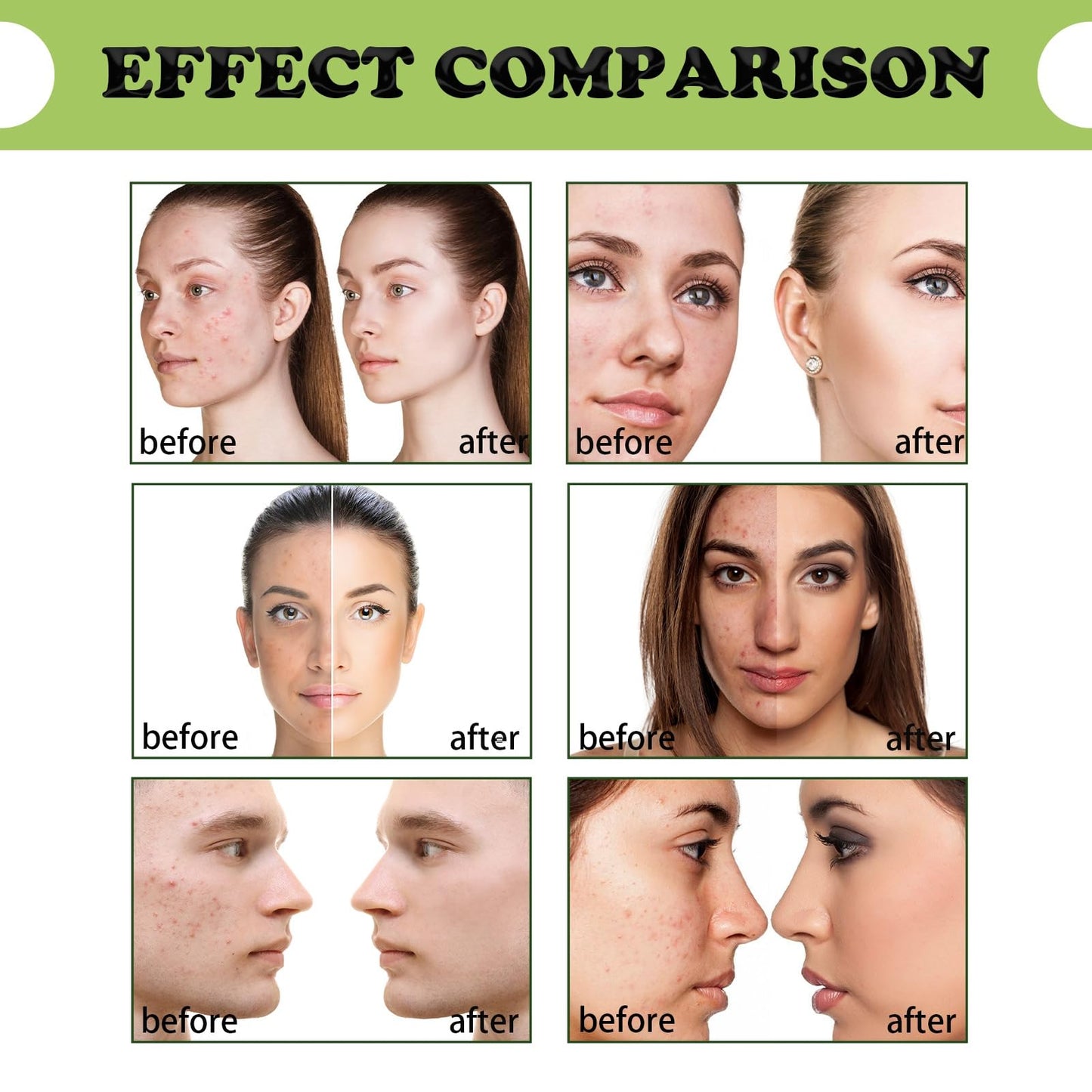30ml Noni Ampoule Serum,Noni Fruit Serum,Noni Serum,Noni Extract Facial Serum,Anti Wrinkle Serum,Anti Ageing Serum,Skin Serum,Face Serum for Women,Antiaging Serum,Hydrating Serum,Skincare Serum