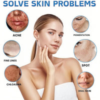 Retinol Gel,Acne Treatment Gel,Acne Control Cream for Face,Anti Acne Gel for Spot Prone Skin,Retinol Moisturizer Cream,Brightens Skin and Improves Elasticity,Face for Pimple Reduce,Without Over Drying