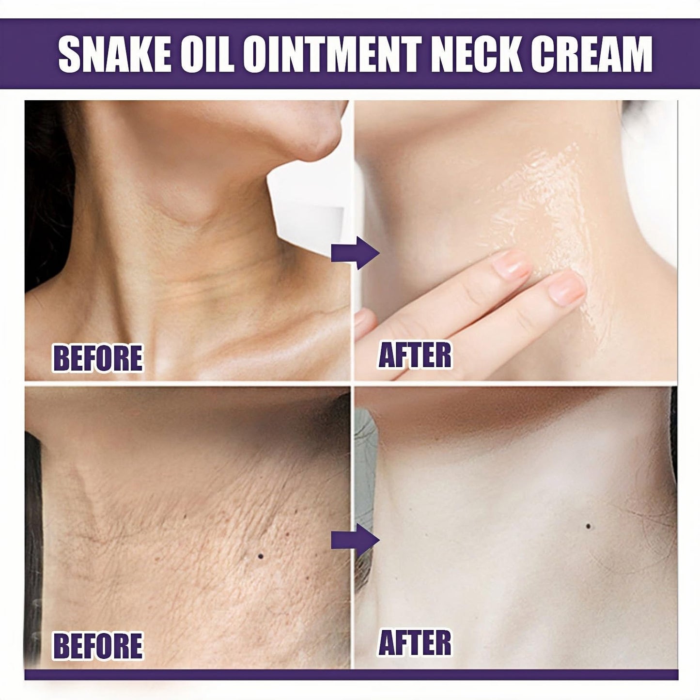 Jinjiar 2PCS Samu Neck Firming Cream,Wak Firming & Lifting Neck Cream,Anti Aging Neck Cream for Sagging and Tighten,Firming Cream for Loose Skin,Ne-ck Tightening Products,Ne-ck Tightening Cream,Ne-ck Firming