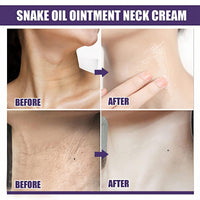 Jinjiar 2PCS Samu Neck Firming Cream,Wak Firming & Lifting Neck Cream,Anti Aging Neck Cream for Sagging and Tighten,Firming Cream for Loose Skin,Ne-ck Tightening Products,Ne-ck Tightening Cream,Ne-ck Firming