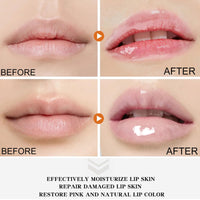 QUIWEN Lip Lightening For Dark Lips, Moisturizing Lip Balm Lip Bleaching for Dark Lips Lip Care Lip Balm Whitening & Brightening Lips Pink Bleaching Cream Balm,Repair Cracked Lips and Remove Dark Lip