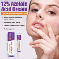 Azelaic Acid Cream, Azelaic Acid Face Serum Cream, Brightening Face Skin Care Treatment for All Skin Types, Repair Dark Spots for Fresher and Smoother Skin, (20g)