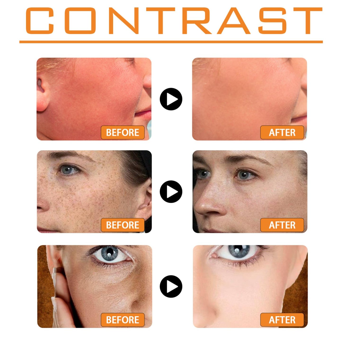 Sunscreen Spf 100 - Face Sunscreen - Waterproof Moisturiser with Spf 100 - UVB/UVA Protection Sun Cream - Factor 100 Sun Cream anti Wrinkle Prevent Sunburn&Taning 50g