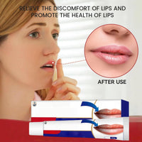 Cold Sore Cream,Cold Sore Treatment Cream,Mouth Ulcer Treatment for Adults,Gentle Sore Lips Treatment,Mouth Sore Treatment for Lips,Mouth Ulcer Gel,Fresh and Non-irritating,Natural Ingredients,20g