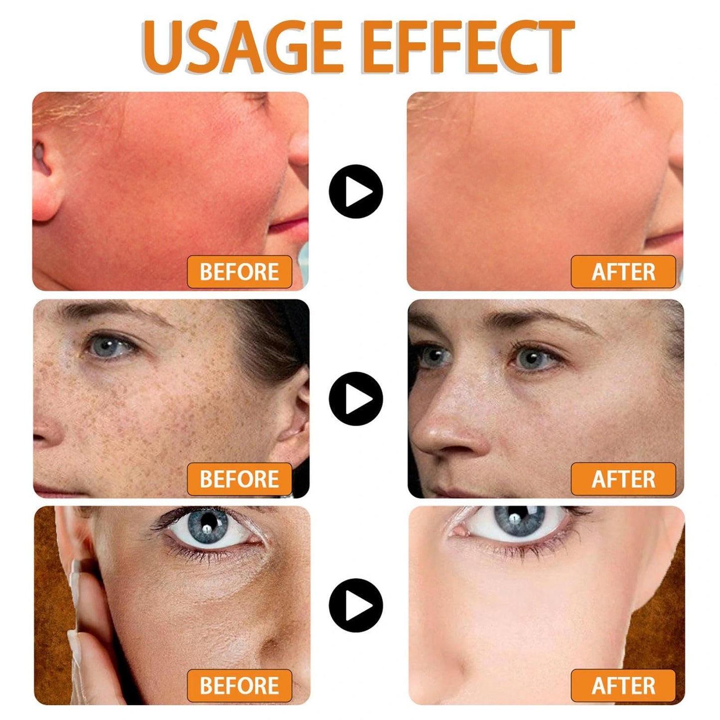 Maggikey SPF 100 Sunscreen - Face Sunscreen - Waterproof Moisturiser With UVB/UVA Protection Sun Cream - Factor 100 Sun Cream Anti Wrinkle Prevent Sunburn 50g