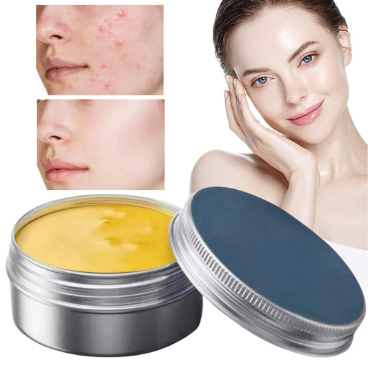 HIVETZ Norse Organics Acne Balm,Norse Organics Acne Cream,Norse Organics Acne and Redness Removal,Acne Clearing Cream,Spot Treatment for Face,Spot Cream for Acne,Ultra-Performance Skincare for Men and Women