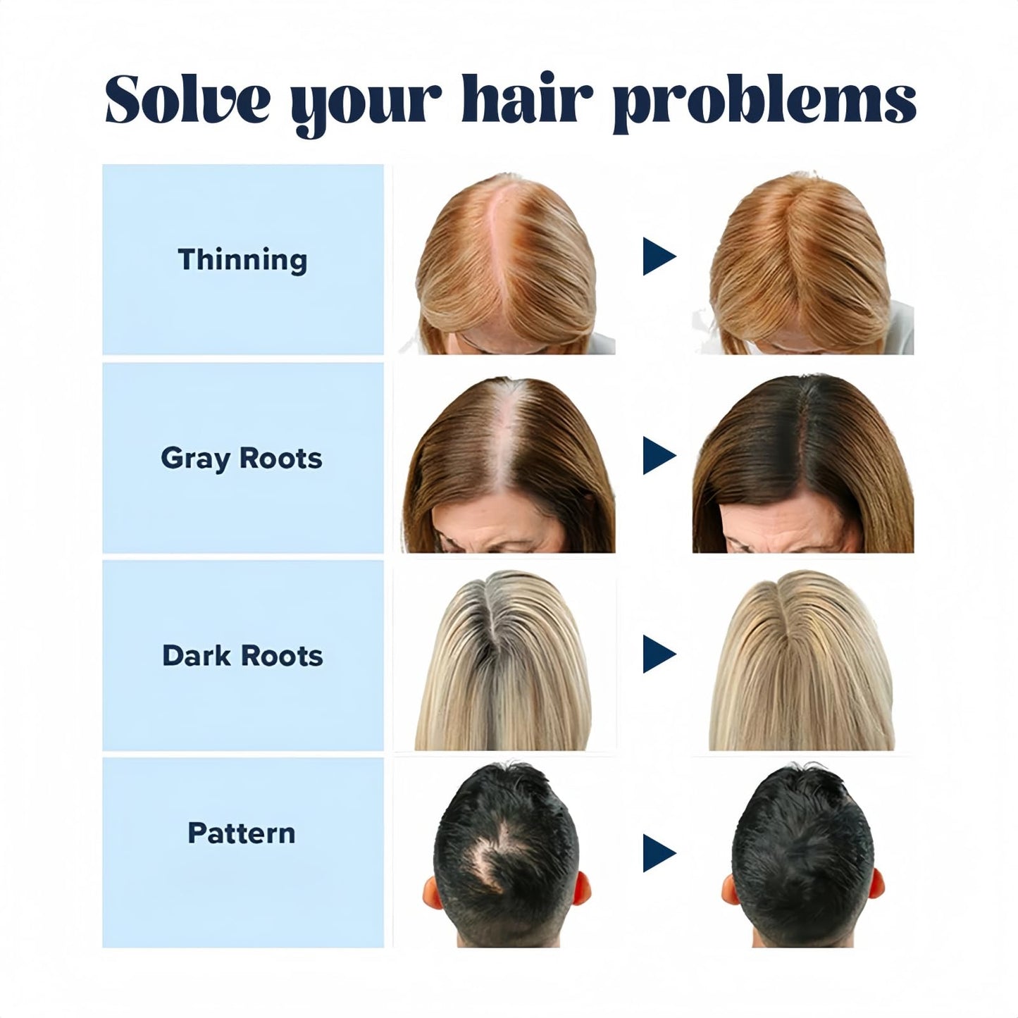 Xunzhi Root Cover up Stick,Hairline Powder Stick,Temporary Hair Color Pen,Double-Ended Temporary Hair Co/lor Hair Roo/t Concealer,Ha/ir Shadow Powd/er,Double Ended Ha/ir Colo/r Sti/ck,Ro/ot Touch up
