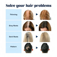 Xunzhi Root Cover up Stick,Hairline Powder Stick,Temporary Hair Color Pen,Double-Ended Temporary Hair Co/lor Hair Roo/t Concealer,Ha/ir Shadow Powd/er,Double Ended Ha/ir Colo/r Sti/ck,Ro/ot Touch up