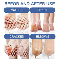Cureluxe Urea Cream 60 Percent for Feet,60% Urea Foot Cream with Salicylic Acid,Foot Cream for Cracked Heels and Dry Skin,Cracked Heel Repair Cream,Deeply Moisturizing & Nourishing Foot Moisturiser,Heel Balm
