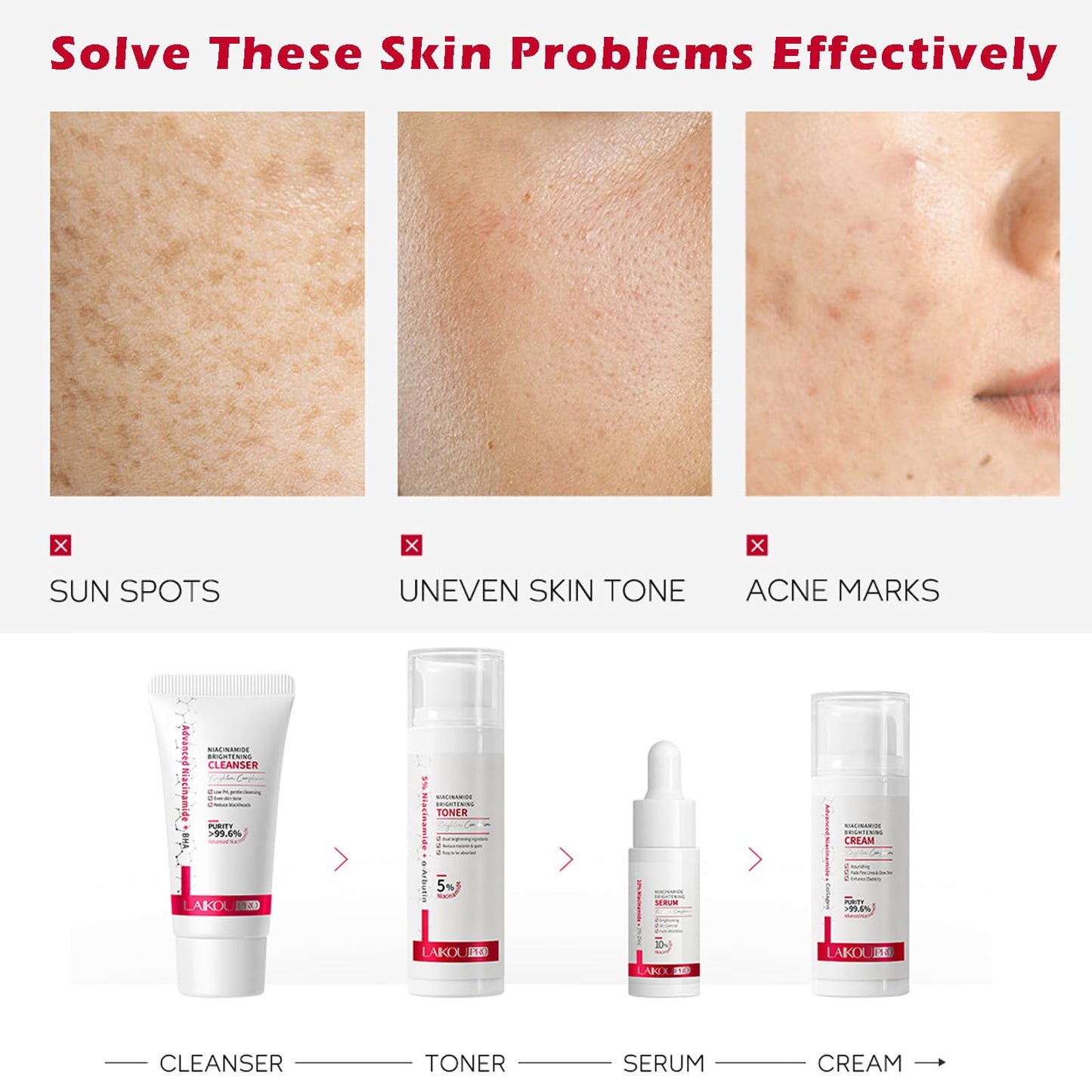 Angivlga Niacinamide Skincare Set Gifts For Women & Girls, Brightening Anti-Aging Skin Care Improve Dark Spot And Even Out Skin Tone - Korean Skin Care Pamper Gifts For Women