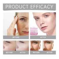 Xinyig Infusion Micro Facial System,Glow Infusion Micro System,Hyaluronic Acid Microneedling Essence for Glowing Skin,Smooth Skin Facial Serum,Micro Anti-Aging Facial System,Micro Needling Kit,Skin-Firming