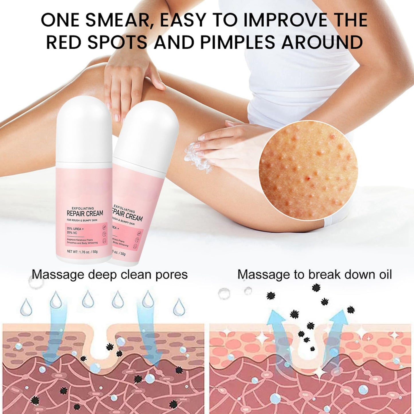MEITREND Strawberry Skin Treatment,Skin Exfoliating Repair Cream with 20% Vitamin C and 25% Urea,Strawberry Legs Treatment Rough Bumpy Skin Body Lotion Moisturizing Cream,Chicken Skin Care Cream