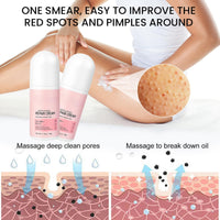 MEITREND Strawberry Skin Treatment,Skin Exfoliating Repair Cream with 20% Vitamin C and 25% Urea,Strawberry Legs Treatment Rough Bumpy Skin Body Lotion Moisturizing Cream,Chicken Skin Care Cream