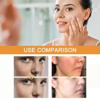20% Vitamin C Serum Face,Anti-Aging Face Serum,Anti Wrinkle Facial S/erum,Vit C S/erum,Collagen Boosting and Skin Brightening Facial Se/rum,Brighten Hydrate F/ace Se/rum,F/ace Moisturiser,30ml