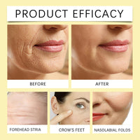 AuraBeen 24K Gold Serum for Face - Pure Gold Hydrating Serum for Glowing Complexion, Deep Hydrating, Improve Skin Texture