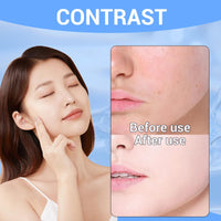 Asheyya Centella Clay Mask Stick, Portable Quick Clay Stick for Face Moisturizing Skin Barrier Fix