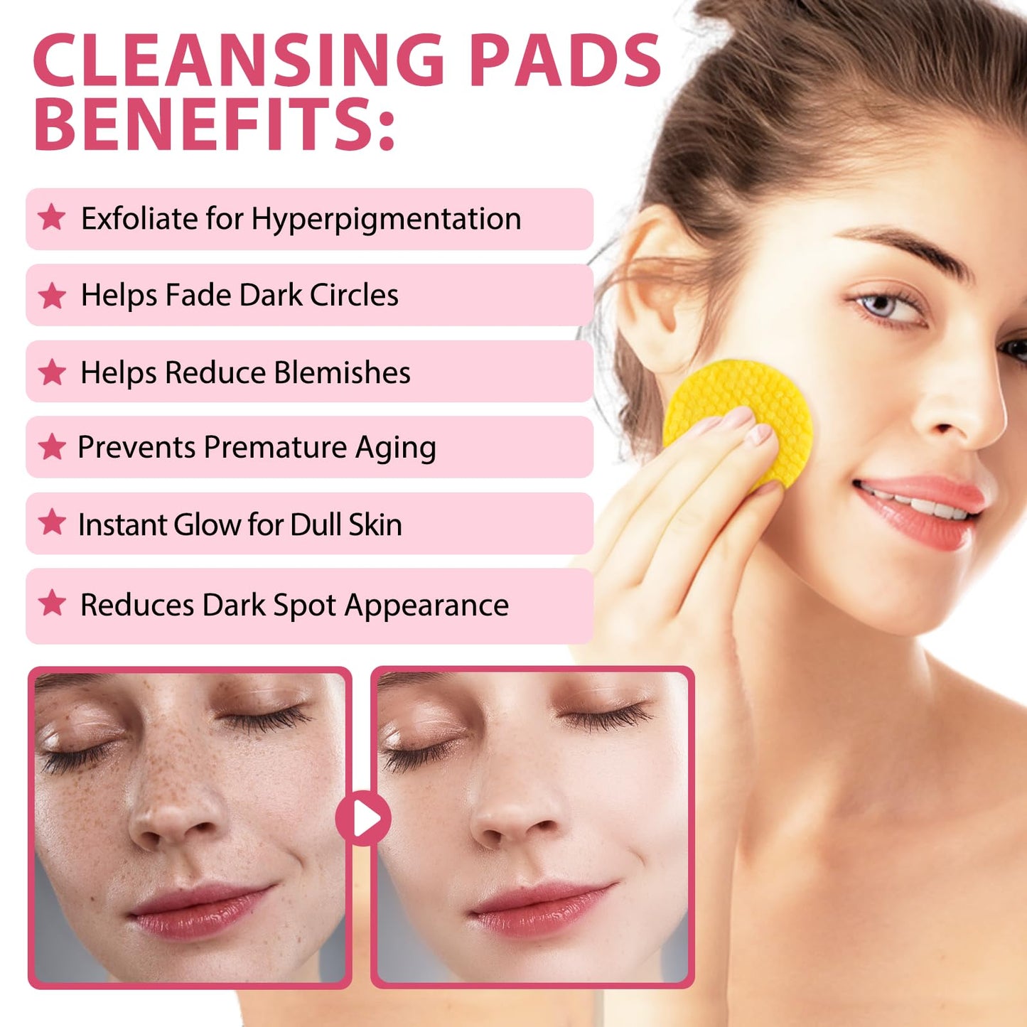 Generic Turmeric Kojic Acid Cleansing Pads 40Pcs, Turmeric Exfoliating Foaming Pads, Fight Acne, Balance Skin Oil And Water, Lighten Blemishes, Brightens Skin Tone, Safe For Sensitive Skin