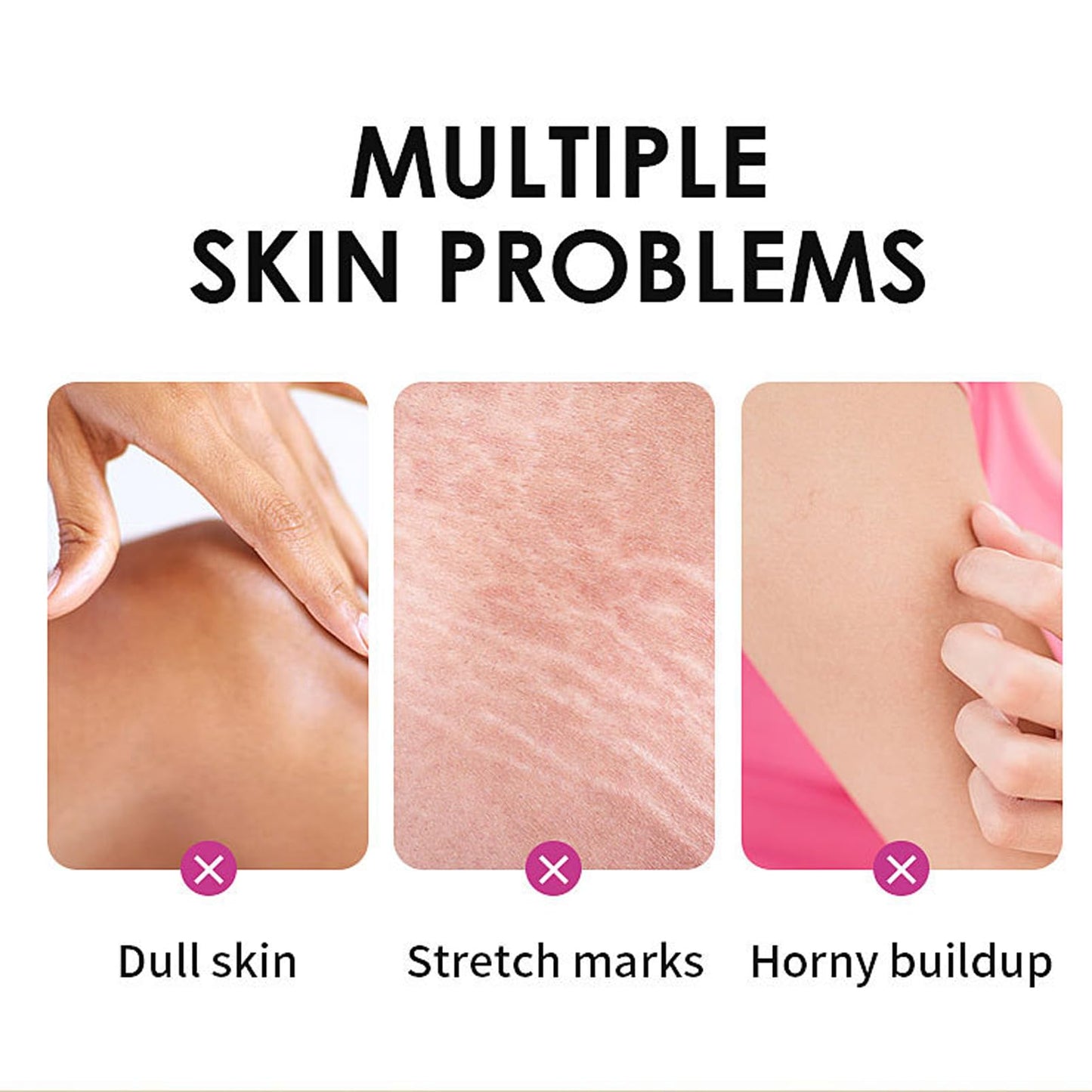 Yellow Peeling Oil - Lightening Exfoliating Dark Skin For Body, Strong Peeling Oil, Skin Peeling Oil For Skin Lightening, Peeling Oil For Skin Brightening Moisturizing, Peeling Solution Dark Skin