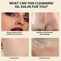 Xinyig 100ML Centella Cleansing Oil,Centella Light Cleansing Oil,Oil-Based Facial Cleanser Gentle Makeup Removal,Centella Cleanser and Makeup Remover,Cleansing Oil and Cleansing Foam,Deep Cleansing of Pores