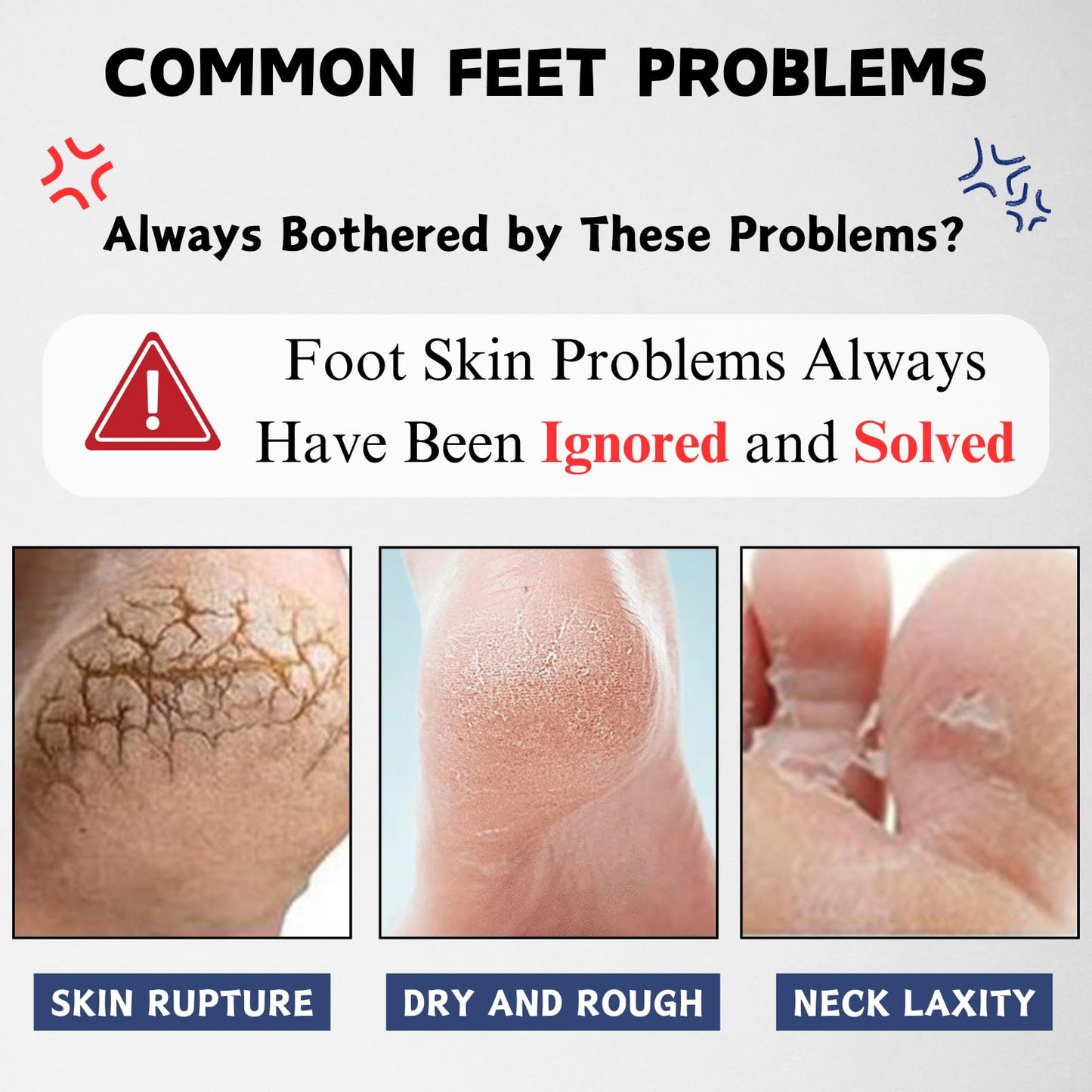 ISBEAUSOLS 40% Urea Cream, Urea Foot Cream for Cracked Heels And Dry Skin, Foot Care for Deeply Moisturizing & Nourishing, Urea Cream Softens Hand & Foot Skin, Foot Moisturiser for Women & Men, 150g