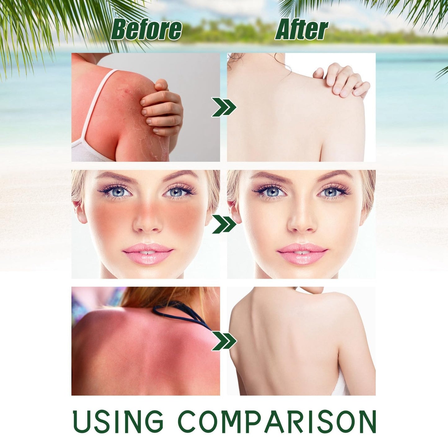 Siyinzu Beef Tallow Sunscreen Spf 50+,Beef Tallow Sun Cream SPF 50,Grass Fed Be/ef Tallow Natural Sun/screen,Natural Tallo/w Sun Crea/m for Face/Body,Non Greasy Sun C/ream Spf 50,Sunscree/n for Oily/Dry Skin