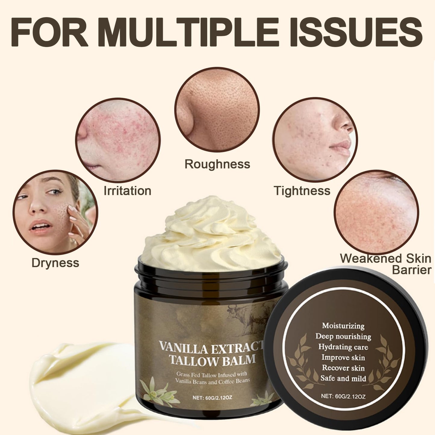 Whipped Tallow Cream - Beef Tallow Moisturiser & Tallow Balm for Dry & Sensitive Skin, 100% Grass Fed Beef Tallow for Skin Care, Enriched with Vanilla Extract, Natural Nourishing for Face & Body