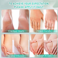 Jinjiar Urea Foot Cream,Urea Foot & Hand Cream for Dry Cracked,Cracked Heel Repair Cream,Fo-ot Cream for Cra-cked Heels and Dry Skin,Foot Moisturiser for Dry Cra-cked Feet,Fo-ot Peel,Fo-ot Care Products