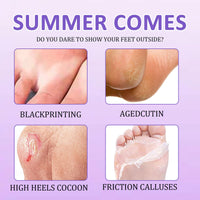 Nadiaen 4Pack Foot Peel Mask for Hard Skin, Exfoliating Foot Peel Mask, Callus Remover, Foot Care Mask for Cracked Heel, Dead & Dry Skin, Moisturizing Feet Peeling Mask for Women&Men - Lavender