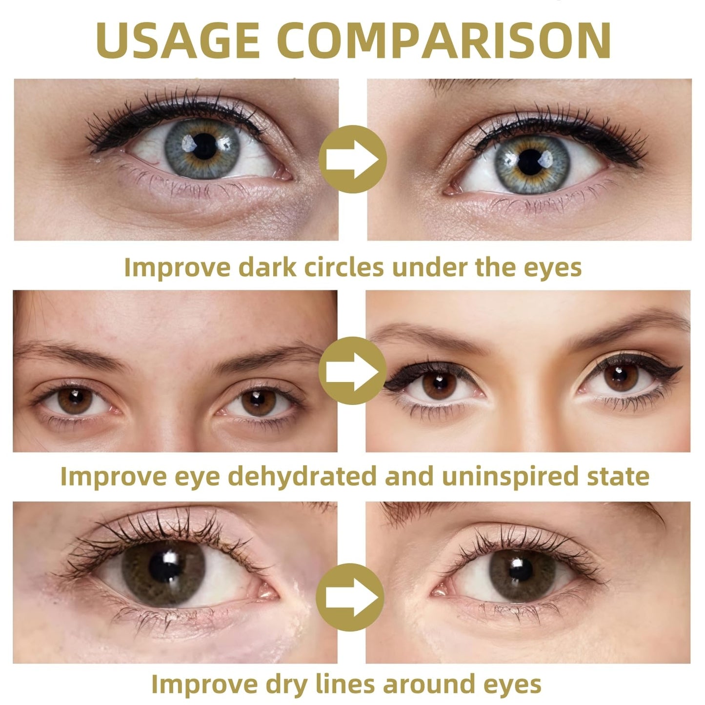 Fankayi Dissolving Micro-Needle Eye Patches,Anti Wrinkle Patches,Micro-Needle Patches for Dark Circles & Puffy Eyes,Under E-ye Gel Patches,Hydrating E-ye Patches,Hydro-gel E-ye Patches,E-ye Cooling Gel Pads