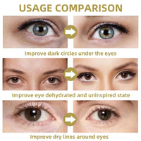 Fankayi Dissolving Micro-Needle Eye Patches,Anti Wrinkle Patches,Micro-Needle Patches for Dark Circles & Puffy Eyes,Under E-ye Gel Patches,Hydrating E-ye Patches,Hydro-gel E-ye Patches,E-ye Cooling Gel Pads
