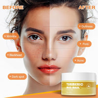 FANFALUV Turmeric Clay Mask-Organic Face Masks Skincare With Vitamin C Helps To Reduce Acne And Dark Spots,Anti-Aging,Firms Skin,Blackhead Remover,Even Out Skin Tone-Turmeric Clay Face Mask (100g)