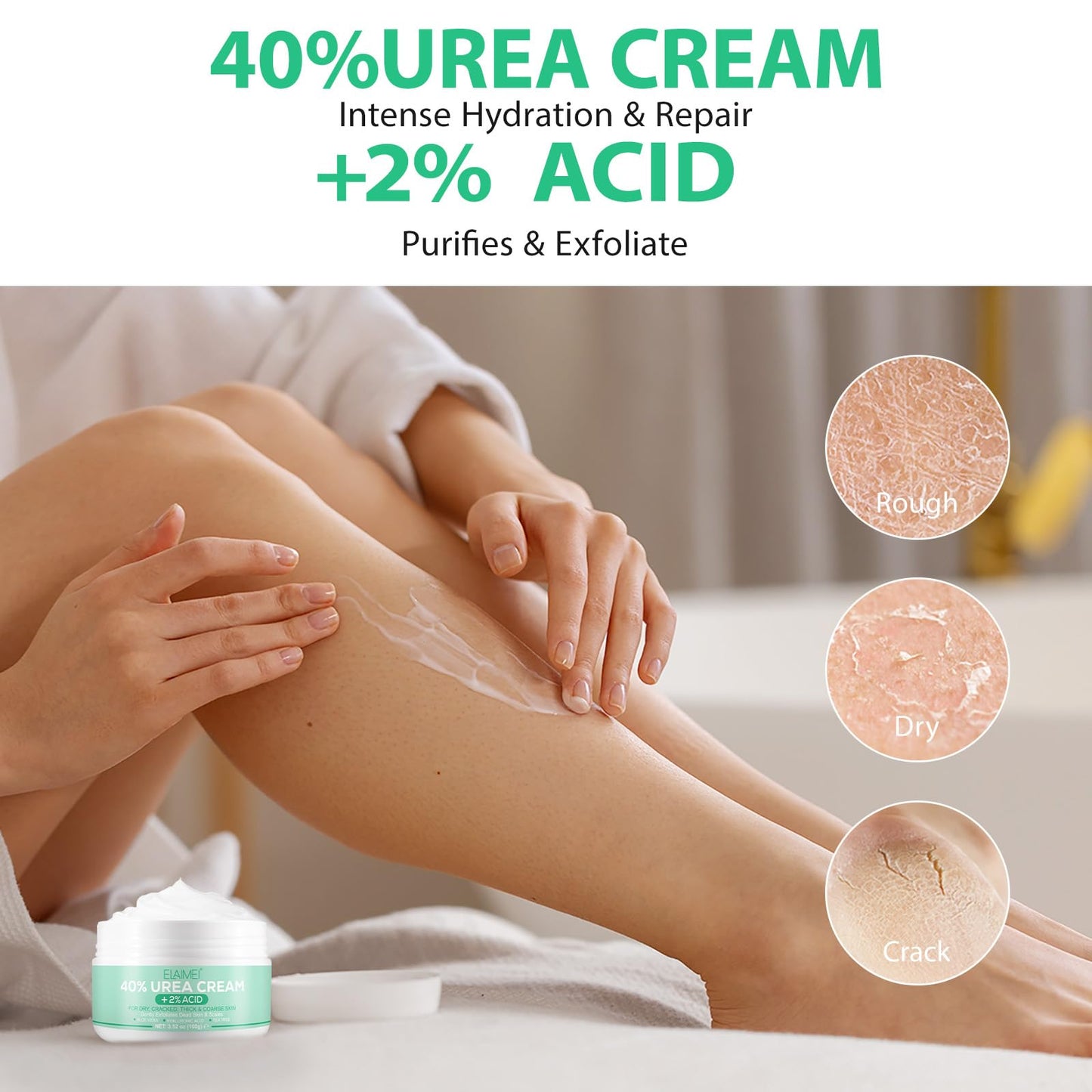 Urea Cream 40 Percent, Urea Foot & Hand Cream for Dry Cracked, 40 per Urea Lotion for Feet-100g