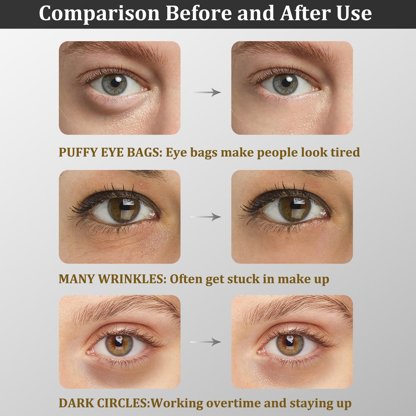 CGBOOM Under Eye Patches, Collagen Under Eye Mask, Dark Circles Under Eye Treatment, Puffy Eyes Bags Under Eyes Removal, Anti-Aging, Reduce Wrinkle, Skincare, Hydrating - 30 Pairs (Bamboo Charcoal)