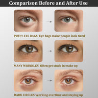 CGBOOM Under Eye Patches, Collagen Under Eye Mask, Dark Circles Under Eye Treatment, Puffy Eyes Bags Under Eyes Removal, Anti-Aging, Reduce Wrinkle, Skincare, Hydrating - 30 Pairs (Bamboo Charcoal)