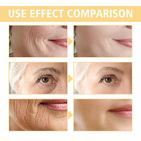 QinZiEn Skips The Line Instant Wrinkle Eraser Face Cream,Face Tightening Cream,Face Moisturiser,Anti Wrinkle F/ace Cr/eam,Anti Aging F/ace C/ream,Night C/ream for Women Anti Aging,Tightening Sagging Skin