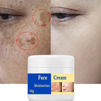 GNAUMORE Spot Remover For Face Serum,Dark Spot Corrector Cream,Sun Spots and Melasma Freckle Remover,Spot Remover For Face Serum,Sun Spots and Melasma Treatment Cream for Face 50G