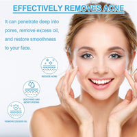 2PCS Acne Treatment Gel,Acne Cream Useful,Anti Acne Face Cream,Anti Acne Removal Cream,Acne Spot Treatment Cream,Pimple Treatment Gel Cream,Face Ance Gel,Acne Treatment Spot and Blackheads Treatment