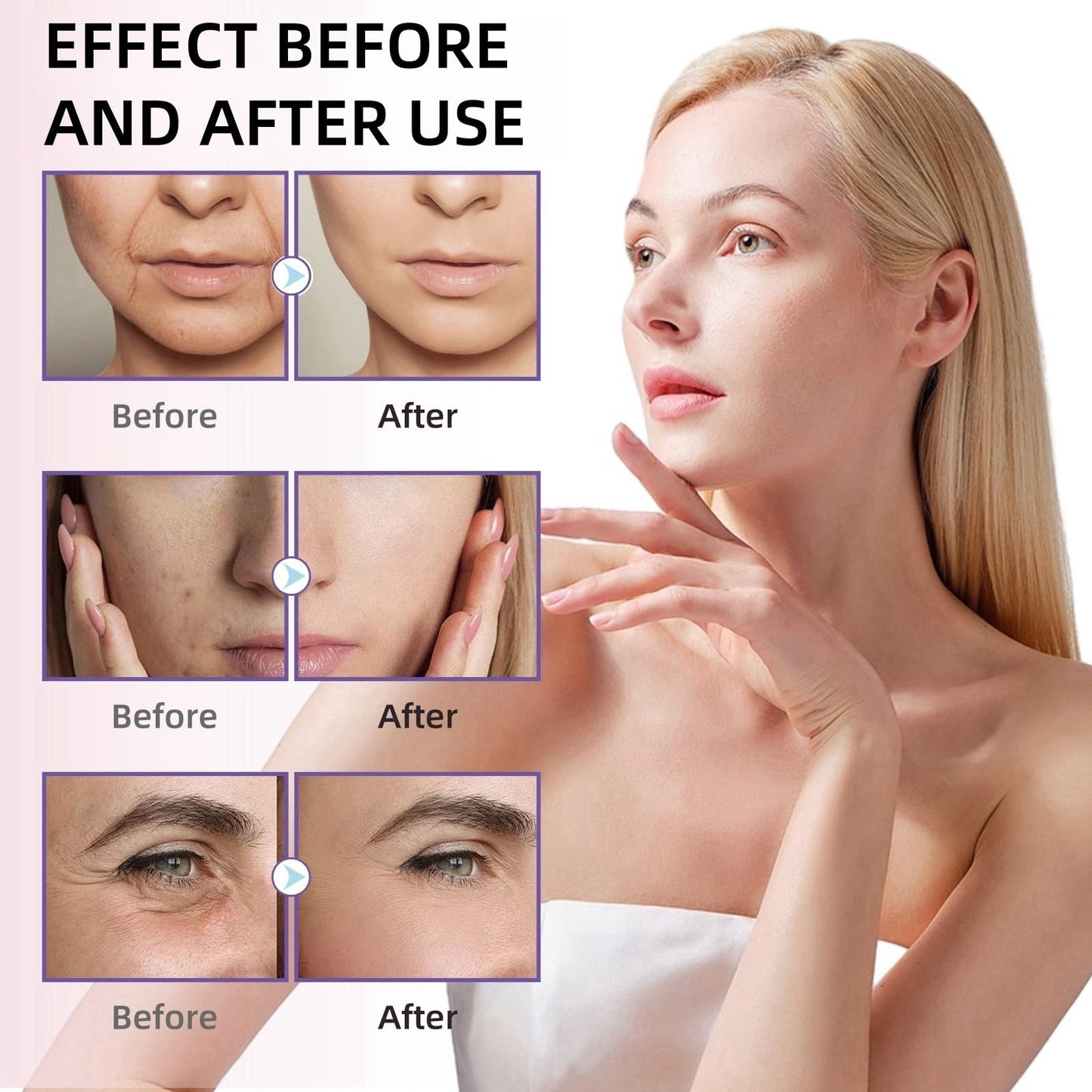 SingHao 3PCS Bee Venom Wrinkle Removal Cream,Bee Ven/om Anti-Wrinkle Cre/am,An/ti Wrin/kle Firming Multi Purpose Cr/eam,Anti Wrink/le Face Moisturizer,Be/e Ve/nom Skin Treatment Cream,Moisturizer C/ream