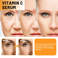 SingHao 2pcs Vitamina C Facial Serum,Anti Aging Face Serum with Vitamin C,Vitamin C Serum for Face,Anti Aging & Wrinkle Facial Seru/m for Women,Brightening Seru/m for Dark Spots,Skin Brightening Se/rum