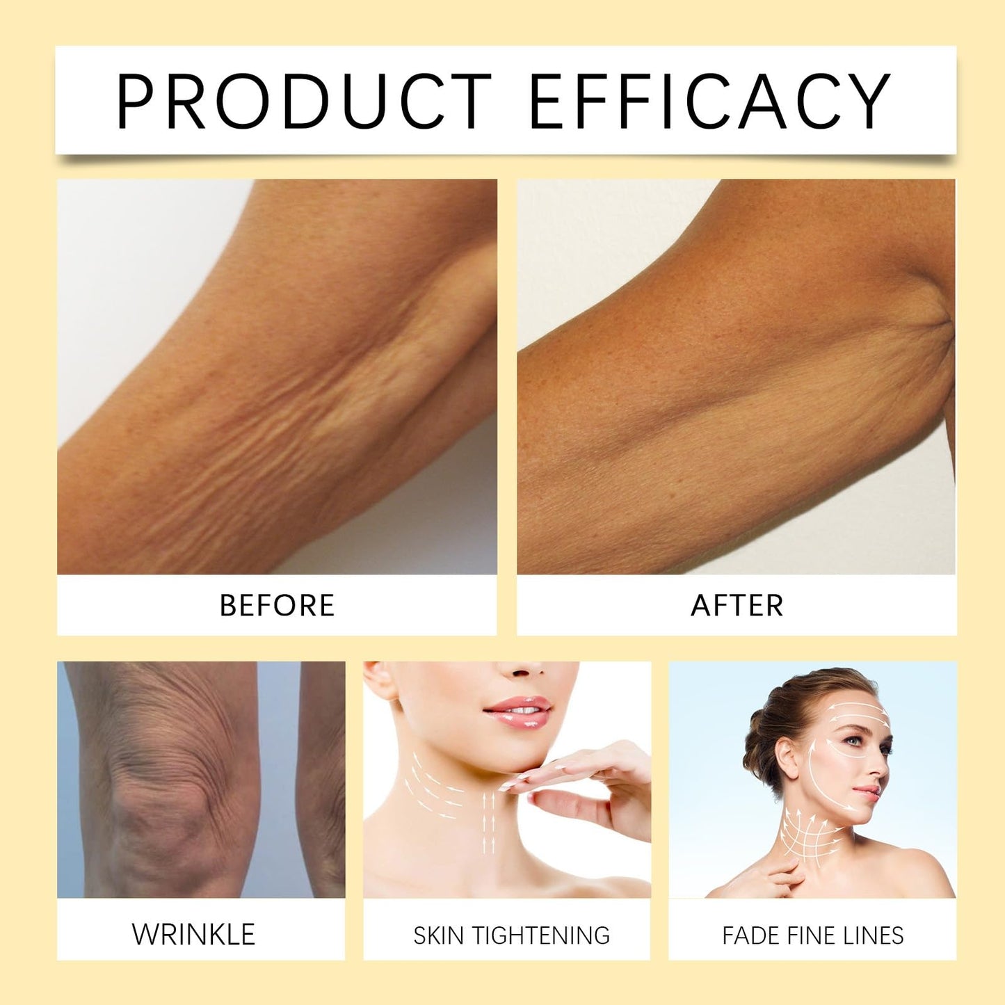 OuXing Bee Ve-nom Retinol Skin Cream,Bee Ve-nom Anti Wrinkle Face Cream,Face Cream,B-ee V-enom Retinol Skin Treatment C-ream,Bee Ven-om Cr-eam,Wrinkle Removal & Moisturizing,Instant Face Lift Cr-eam