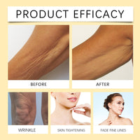 OuXing Bee Ve-nom Retinol Skin Cream,Bee Ve-nom Anti Wrinkle Face Cream,Face Cream,B-ee V-enom Retinol Skin Treatment C-ream,Bee Ven-om Cr-eam,Wrinkle Removal & Moisturizing,Instant Face Lift Cr-eam