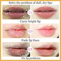 SHEBEEDO Lemon and Turmeric Lip Balm Lightening for Dark Lips,Lip Repair Balm for Brighten & Nourish Dark Lips Effortlessly,Lip Exfoliator Scrub for Softening & Moisturizing,Hydrating Repairing