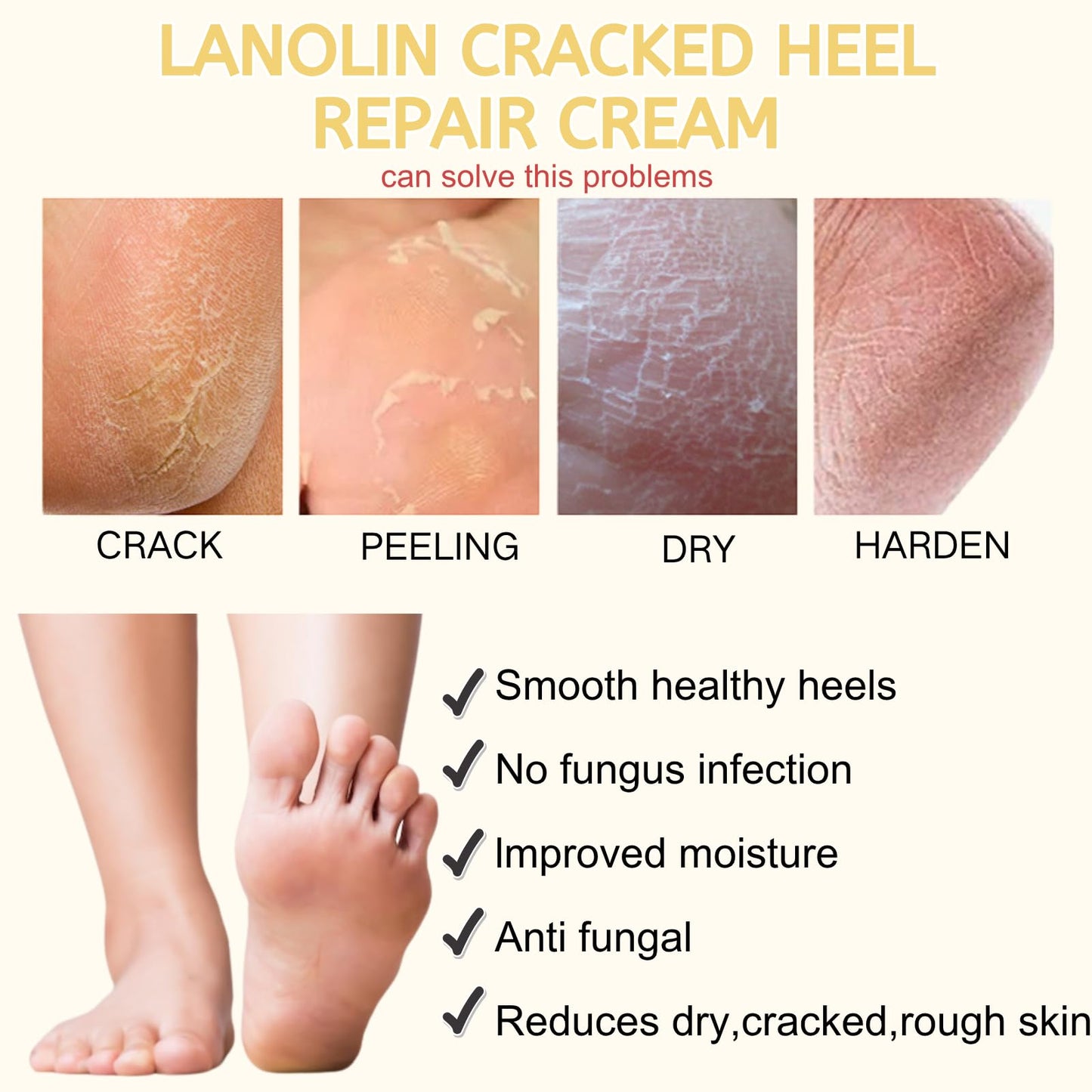 IZBEAUVO Lanolin Hand and Foot Cream Stick, Cracked Heel Repair Cream, Foot Moisturiser for Dry Feet, Heel Balm for Hard Skin & Calluses, Moisturising Foot Cream for Rough Hands and Feet,Hydrating & Nourishing